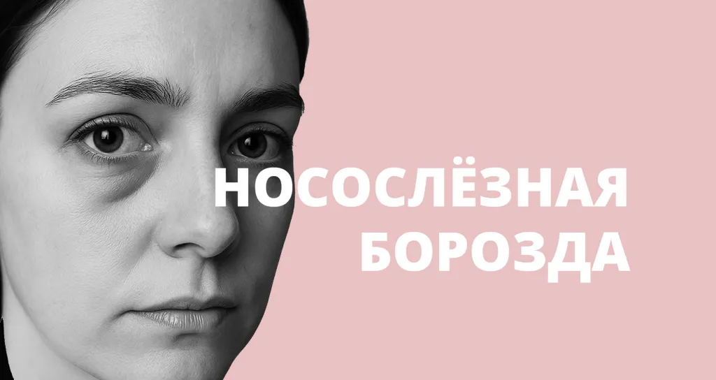 Впадины под глазами