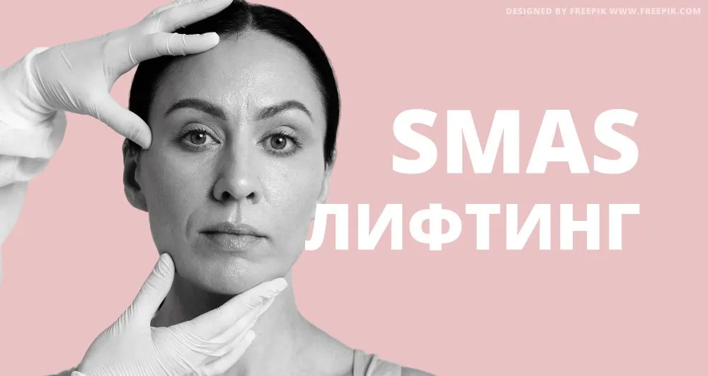 SMAS-лифтинг