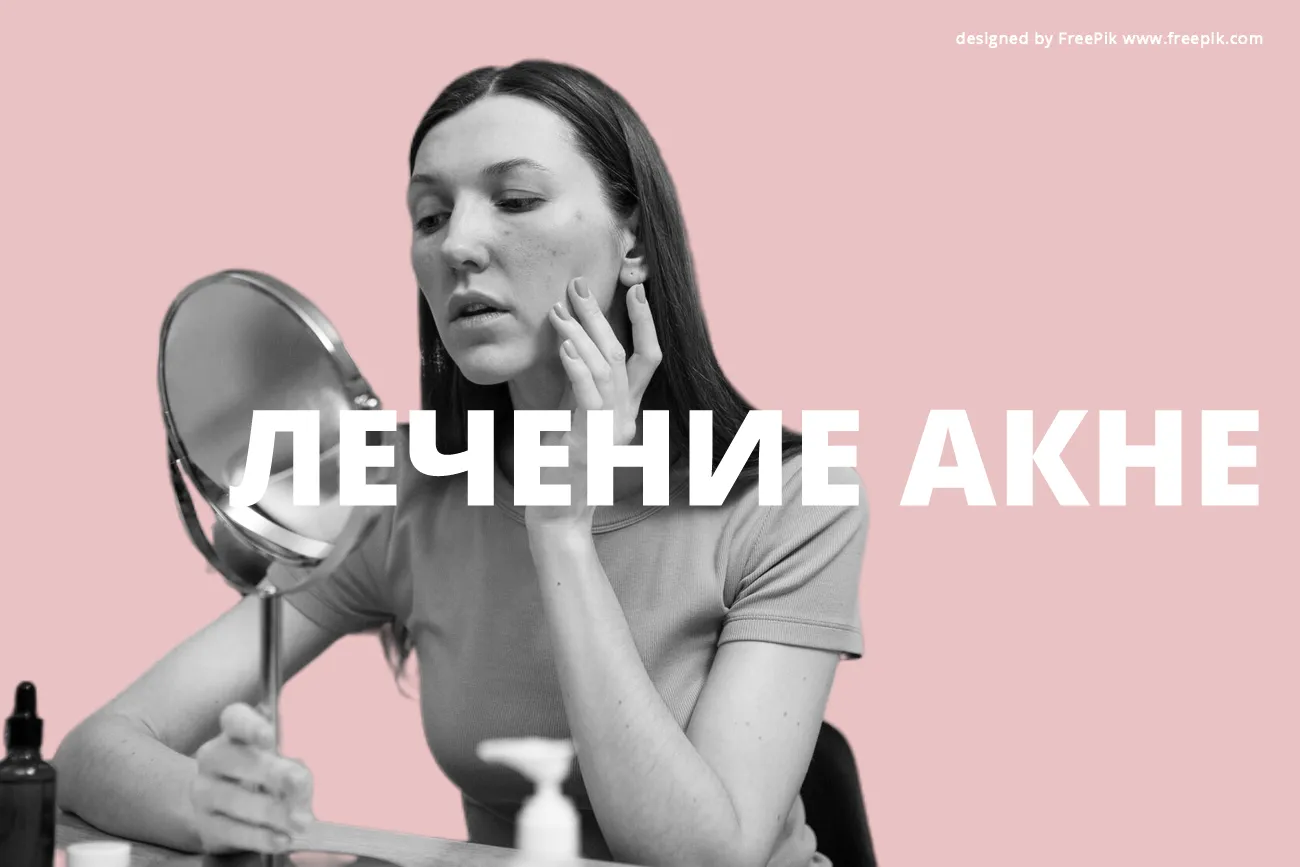 Лечение акне
