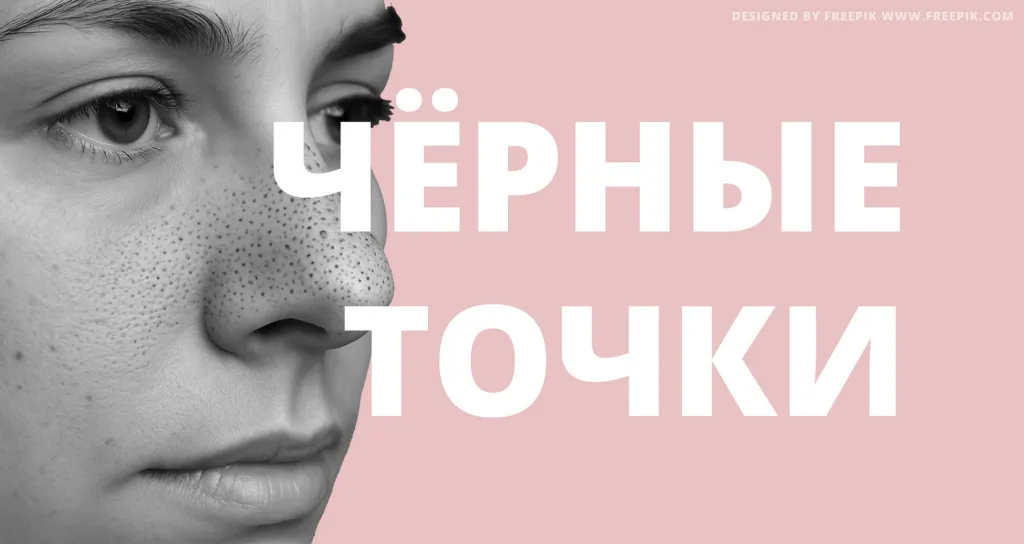 Как избавиться от черных точек