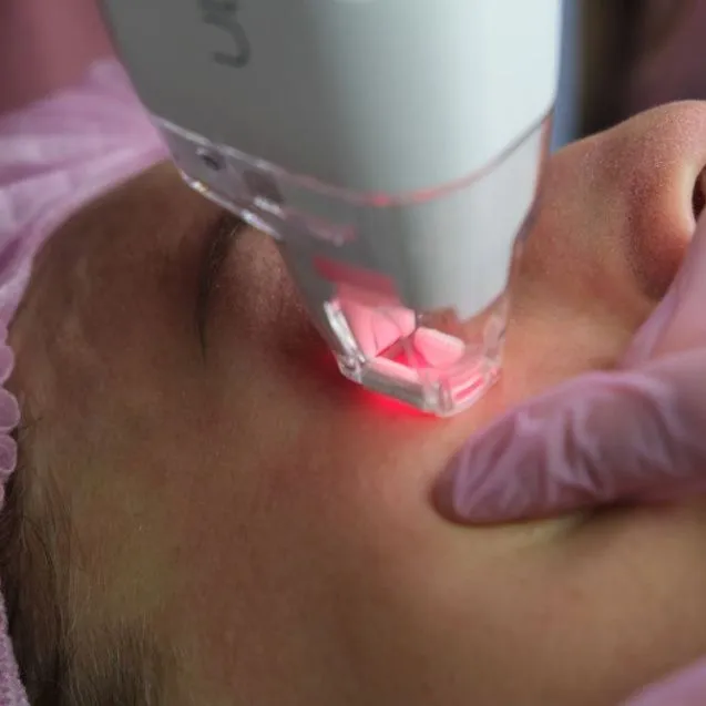 Удаление пигментных пятен на лице