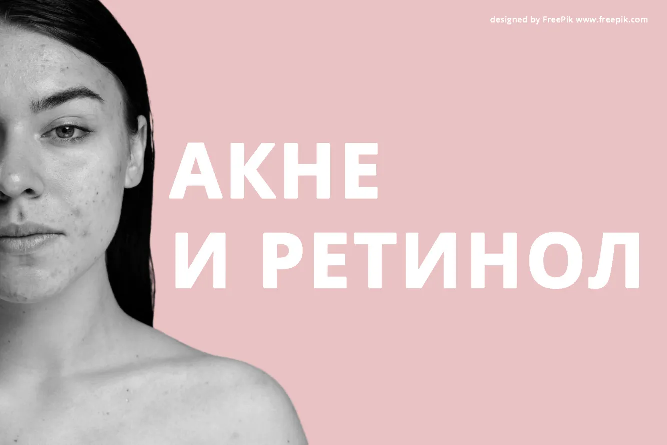 Ретинол при акне
