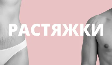 Как избавиться от растяжек