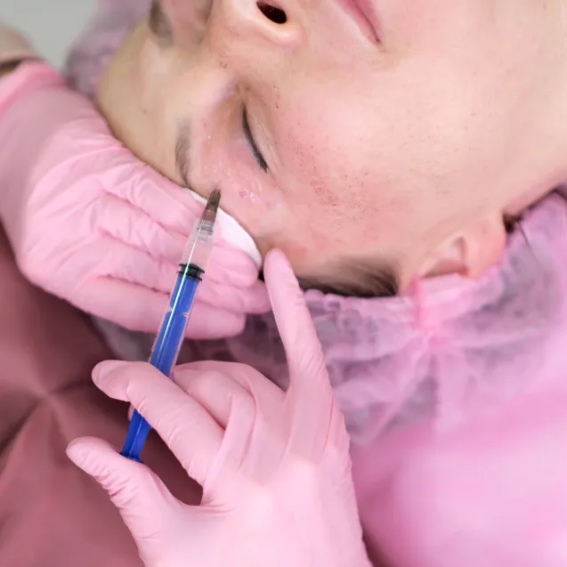 Биоревитализация лица