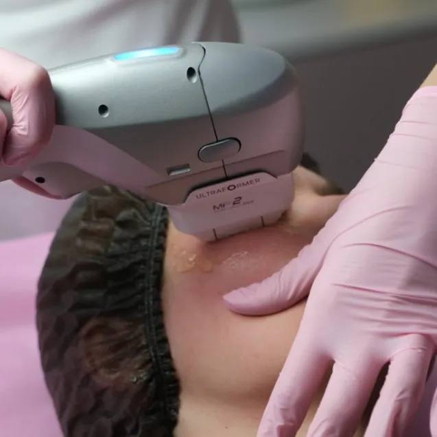 СМАС-лифтинг Ультраформер 3