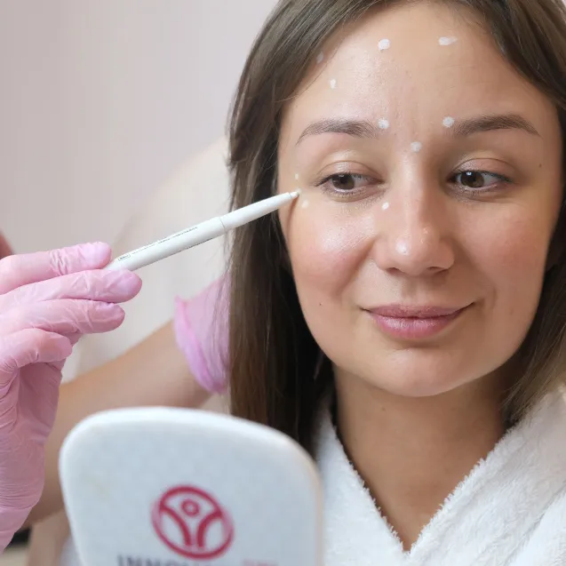 Ботулинотерапия