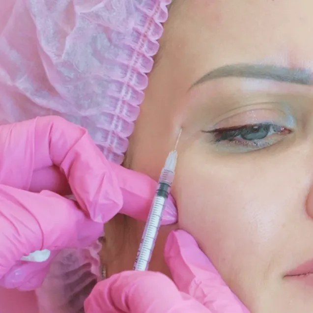 Ботокс вокруг глаз