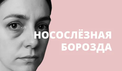 Впадины под глазами