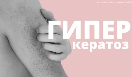 Гиперкератоз