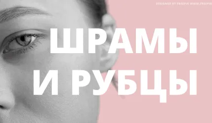 Как убрать рубцы: мнение врача-косметолога