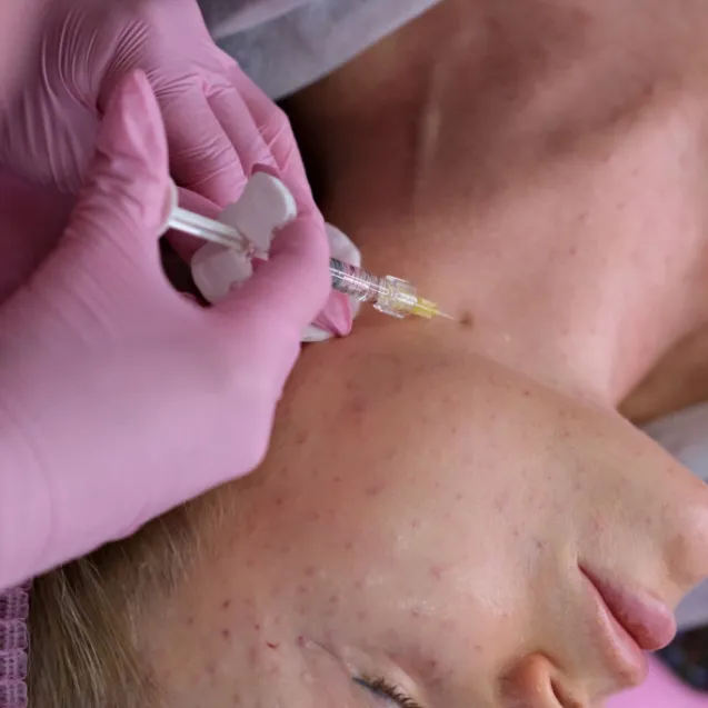 Биоревитализация Плинест