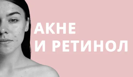 Ретинол при акне