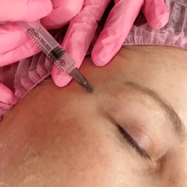 Мезотерапия вокруг глаз