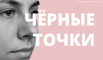 Как избавиться от черных точек