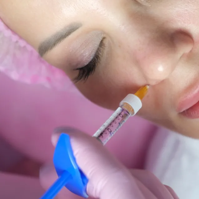 Филлеры в носогубные складки