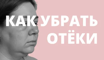 Как убрать отеки
