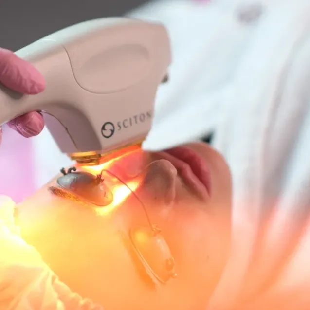 Фототерапия BBL Forever Clear