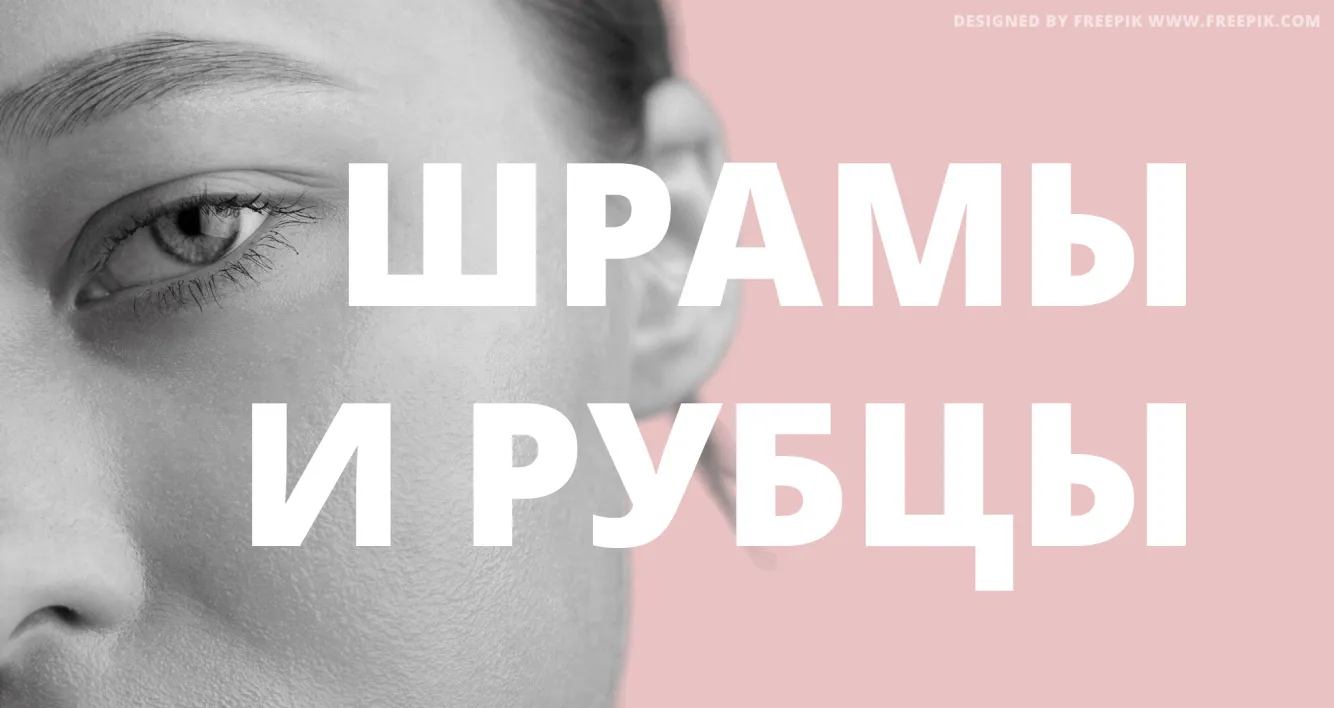 Как убрать рубцы: мнение врача-косметолога