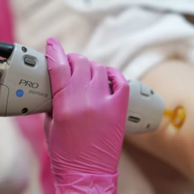 Александритовый лазер