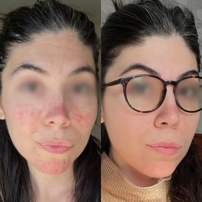 Наружный домашний уход фото до и после 4