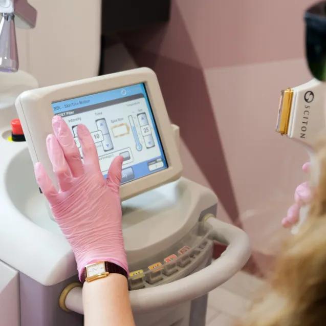 Лечение розацеа лазером