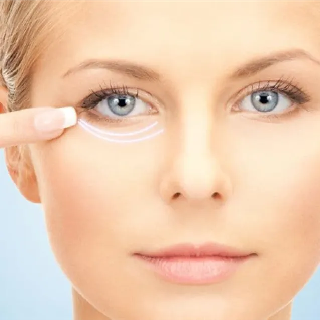 Локальный радиочастотный лифтинг лица AccuTite