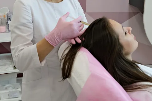 Мезотерапия при проблемах с волосами