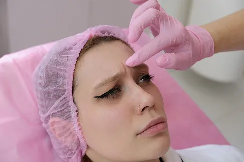 Ботулинотерапия устраняет морщины на лбу