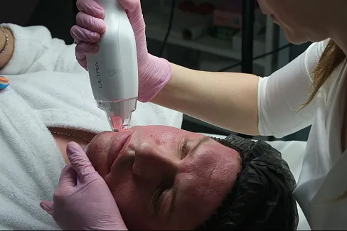 Реабилитация после тулиевого лазера