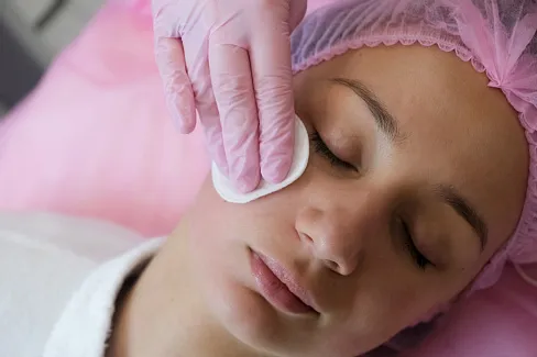 BBL Skin Tyte при мимических морщинах