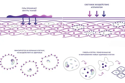 Аппарат Ревиксан для лечения кожи 