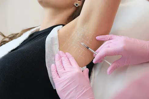 Обезболивание перед лечением гипергидроза