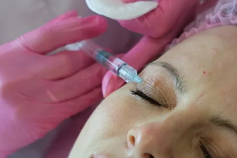 Мезотерапия уменьшает отечность вокруг глаз