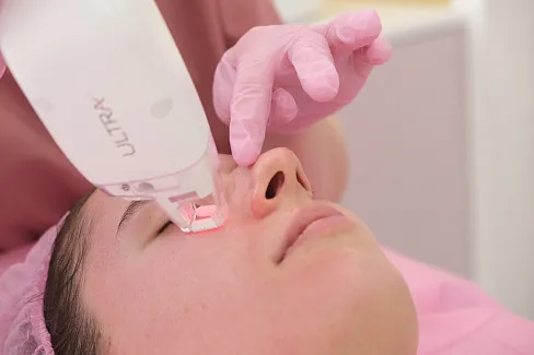 Процедура биоревитализации под глазами