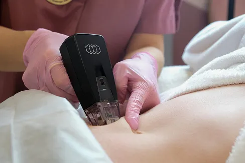 Противопоказания для RF-лифтинга тела 