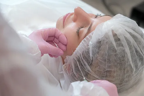 Реабилитация после нитевого лифтинга