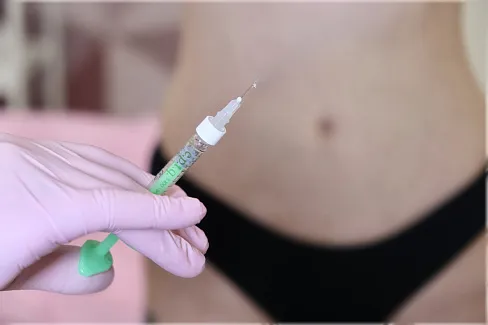 Интимная контурная пластика при асимметрии тканей