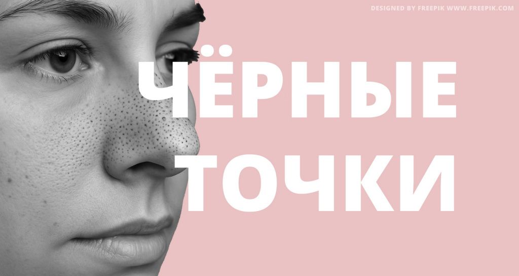 Как избавиться от черных точек