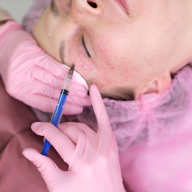 Биоревитализация лица