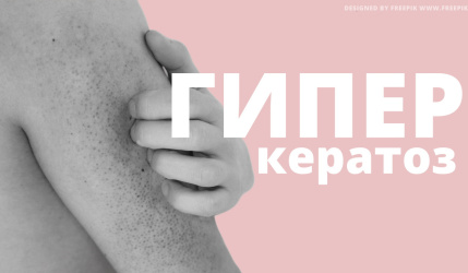 Гиперкератоз