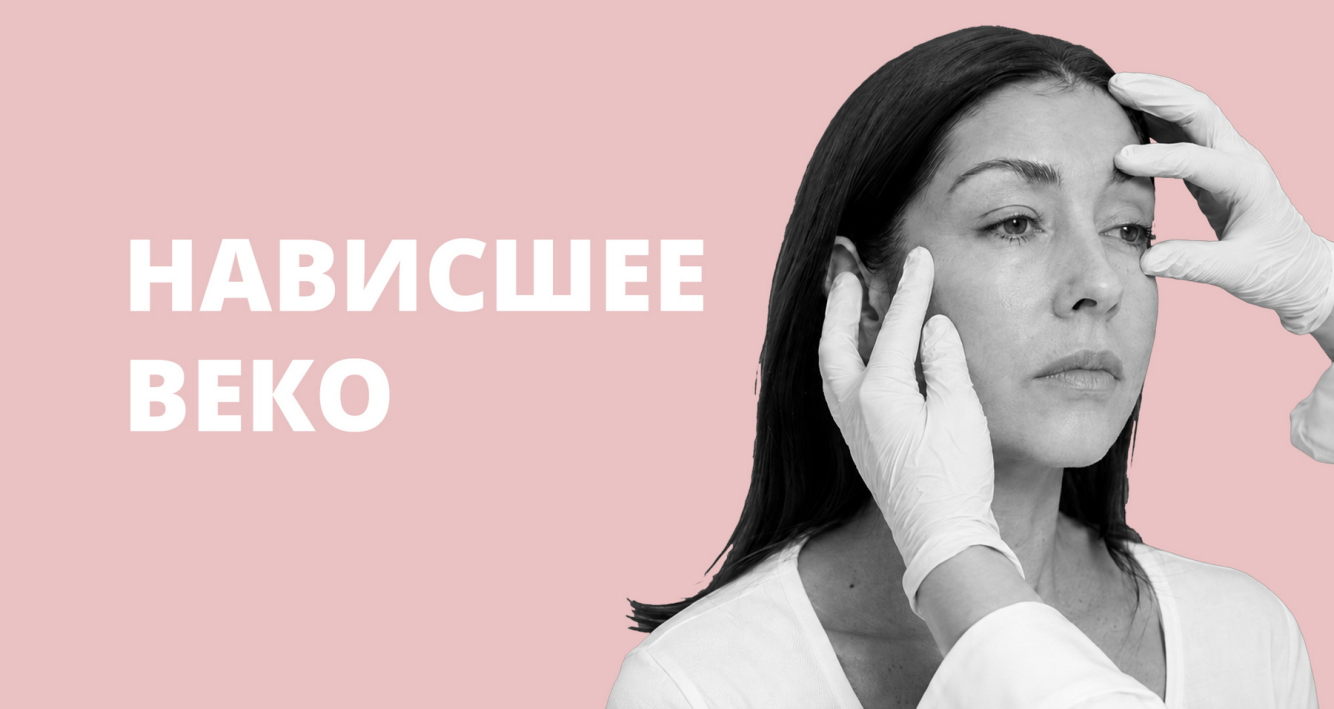 Как убрать нависшее веко