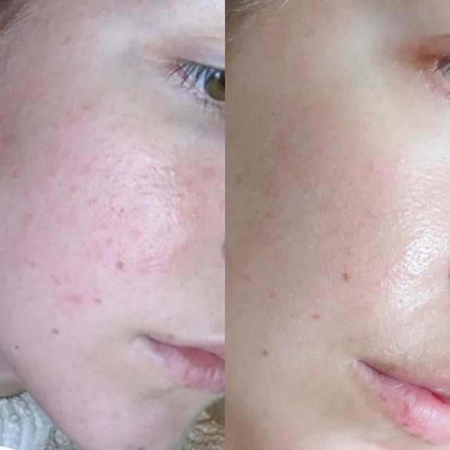 Наружный домашний уход фото до и после 3