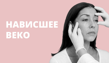 Как убрать нависшее веко