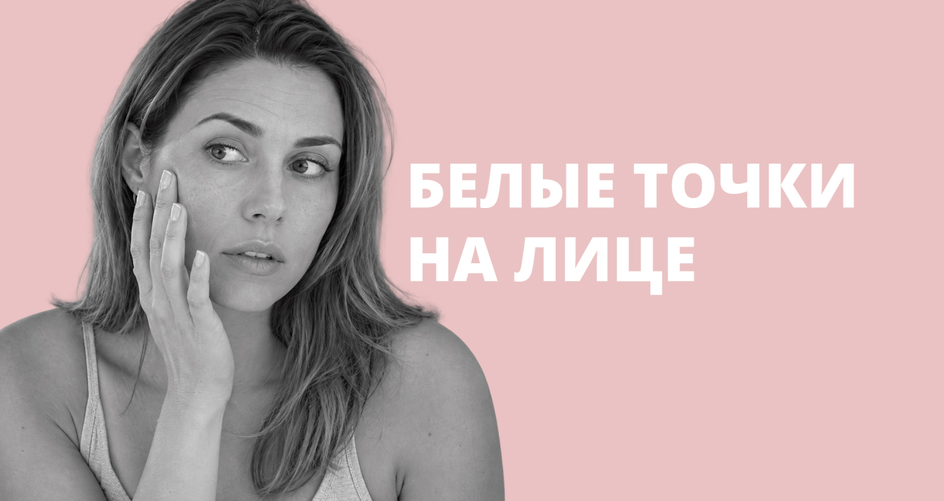 Милиумы