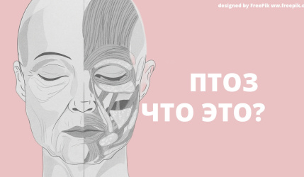 Птоз лица