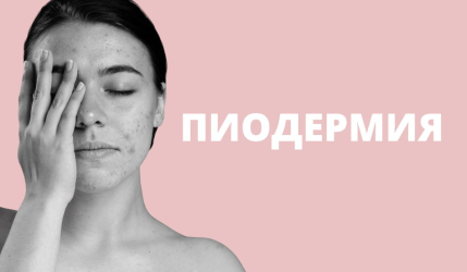 Пиодермия