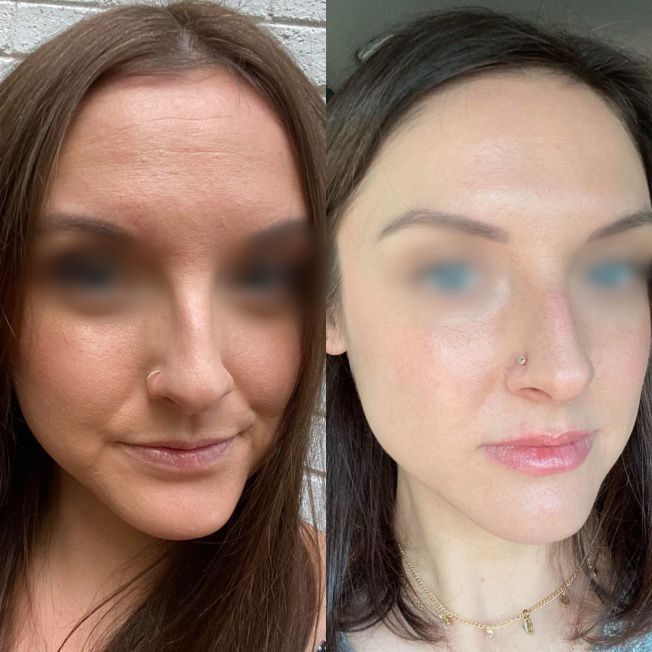 Наружный домашний уход фото до и после 1