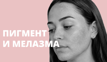 Транексамовая кислота при пигментации и мелазме