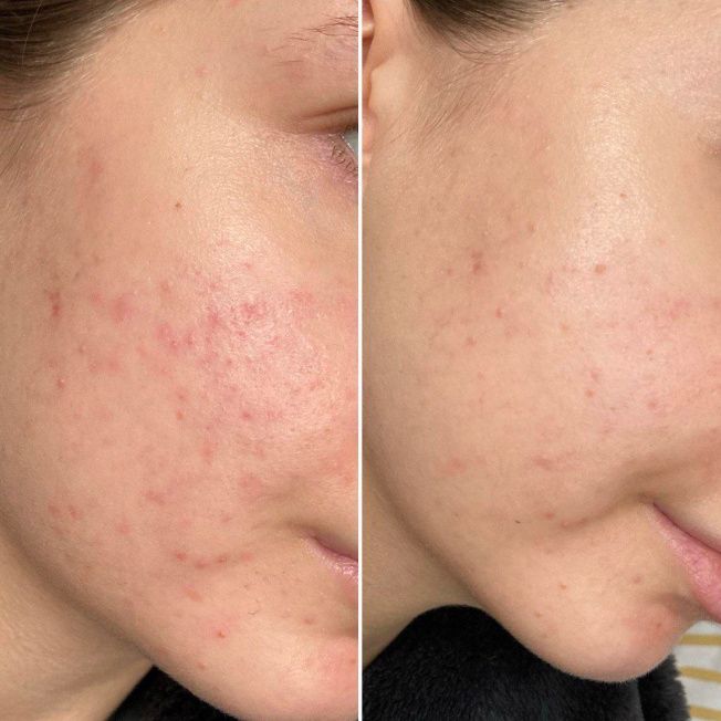 Наружный домашний уход фото до и после 2