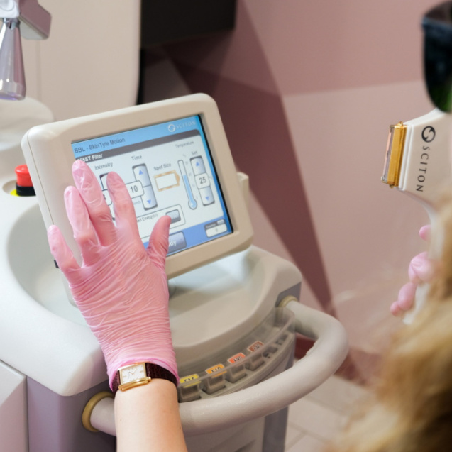 Лечение розацеа лазером